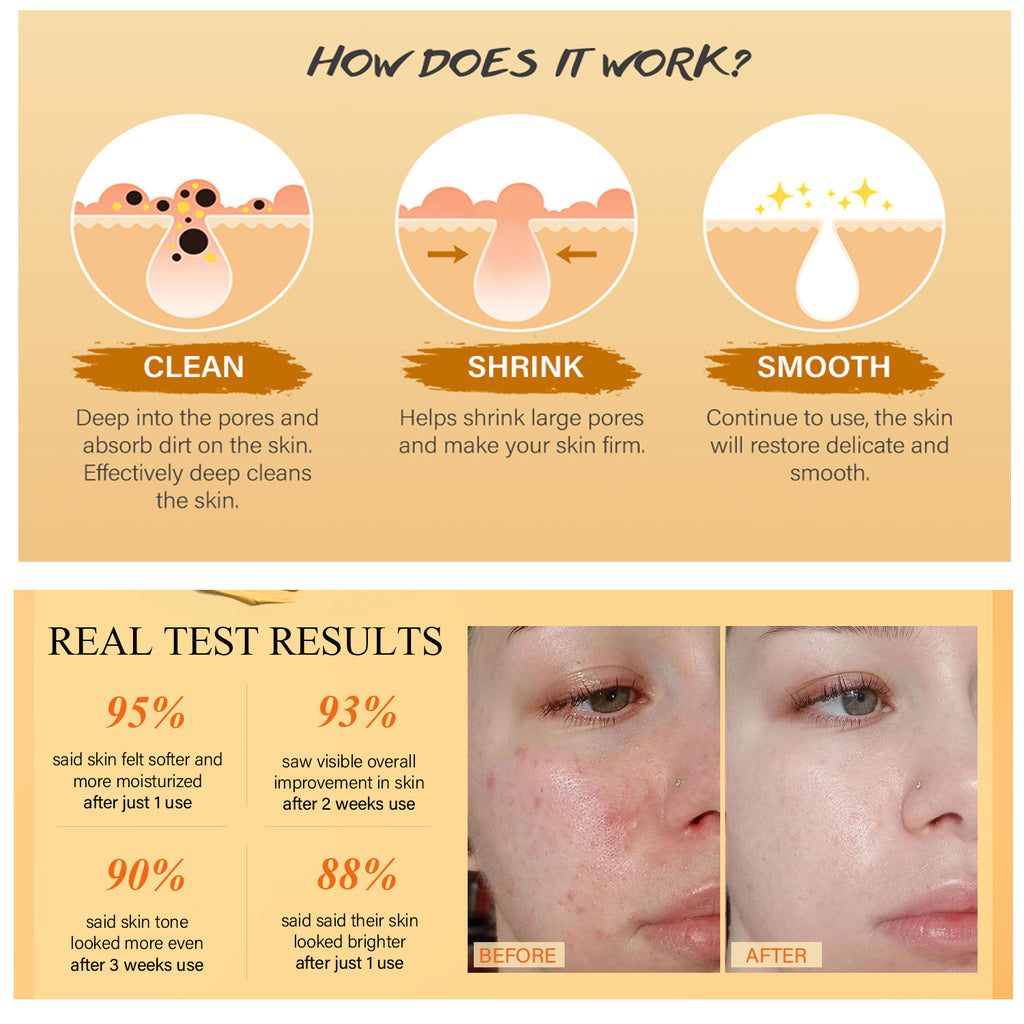 Turmeric Vitamin C Clay Mask With Kaolin Clay For Dull & Blemish-Prone Skin, Deep Cleansing Facial Mask For Controlling Oil And Refining Pores