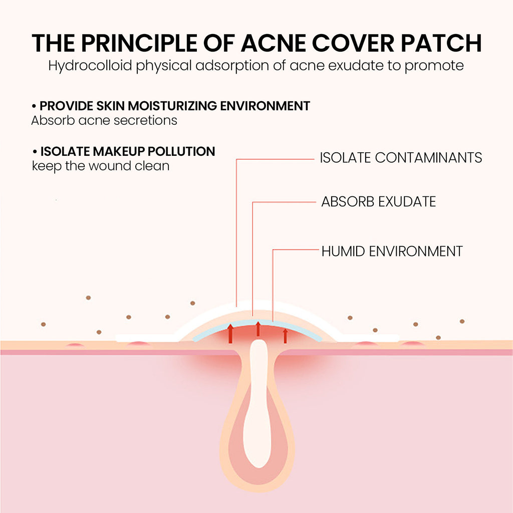 Repair Acne Patch,200patches