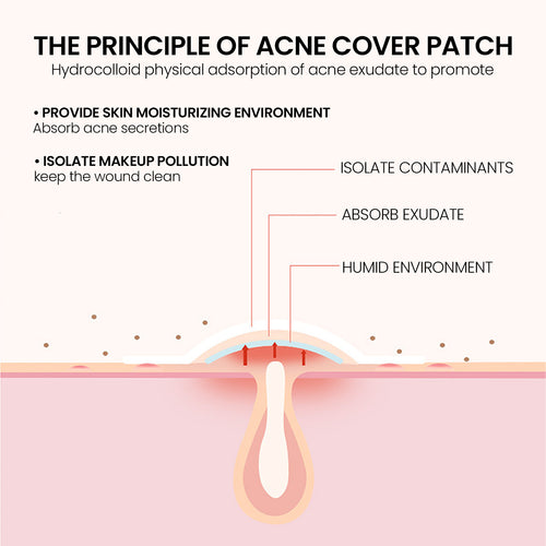Repair Acne Patch,200patches